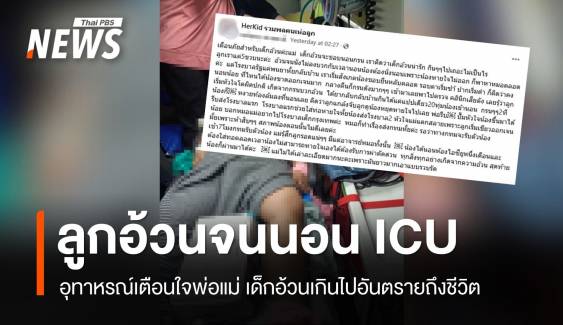 อุทาหรณ์! แม่แชร์ประสบการณ์ลูก 5 ขวบนอน ICU เพราะอ้วนเกิน