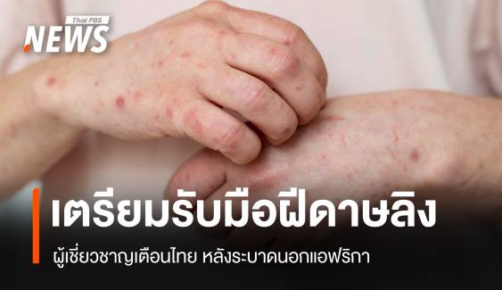 ผู้เชี่ยวชาญเตือน "ไทย" เตรียมรับมือ "ฝีดาษลิง" สายพันธุ์ใหม่