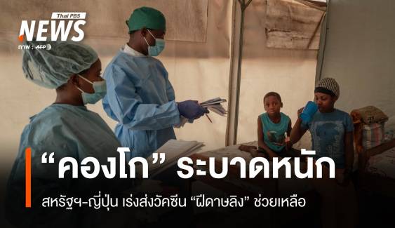 คองโกระบาดหนัก! สหรัฐฯ-ญี่ปุ่น จ่อส่งวัคซีน MPox ช่วยเหลือ