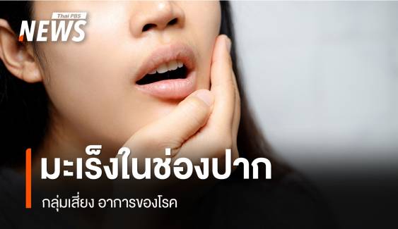 สังเกตอย่างไร แบบไหนเสี่ยง "มะเร็งในช่องปาก"   