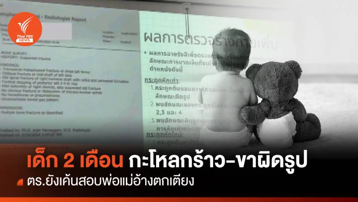 เร่งคลี่ปมเด็ก 2 เดือนเจ็บหนักกะโหลกร้าว-ขาผิดรูป