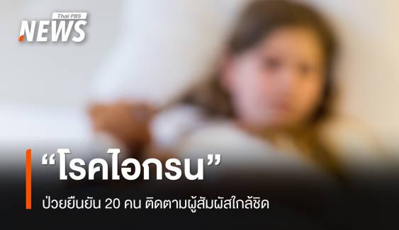 "โรคไอกรน" ป่วยยืนยัน 20 คน ติดตามผู้สัมผัสใกล้ชิด