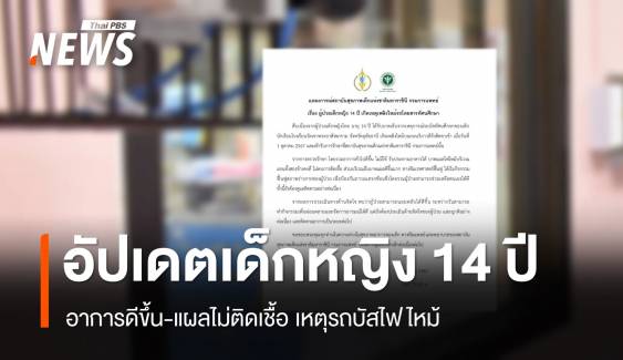 อัปเดตเด็กหญิง 14 ปีรถบัสไฟไหม้ อาการดีขึ้น-แผลไม่ติดเชื้อ