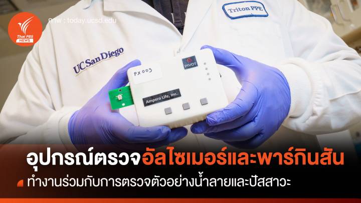 อุปกรณ์พกพาตรวจ "อัลไซเมอร์ - พาร์กินสัน" ผ่านน้ำลายและปัสสาวะ