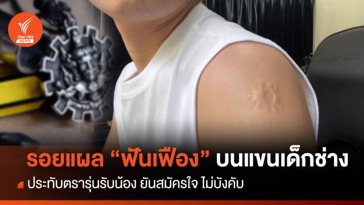 รอยแผล "ฟันเฟือง" บนแขนนักเรียนช่าง ประทับตรารุ่นรับน้อง 