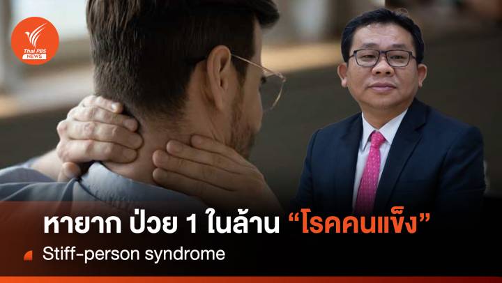 หายาก ป่วย 1 ในล้าน Stiff-person syndrome "โรคคนแข็ง"
