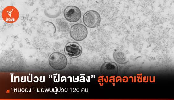 "หมอยง" เผยไทยป่วย "ฝีดาษวานร" 120 คน สูงสุดในอาเซียน