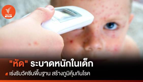 "หัด"ระบาดหนักในเด็ก เร่งรับวัคซีนพื้นฐาน สร้างภูมิคุ้มกันโรค