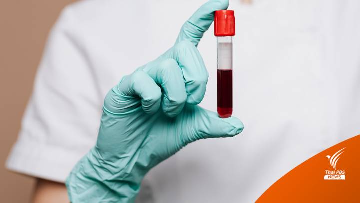 นักวิจัยสังเคราะห์ "เลือดเทียม" ทดลองทางคลินิกครั้งแรกของโลก