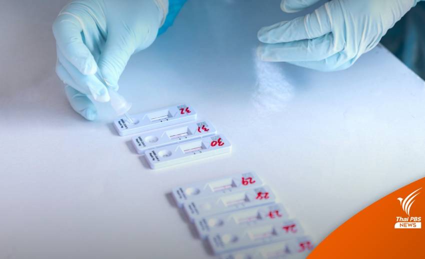 วันแรก! ยอดติดโควิด RT-PCR รวม ATK เกิน 45,000 คน