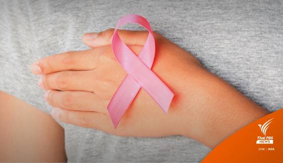 หญิงไทยป่วย “มะเร็งเต้านม” อันดับ 1 เฉลี่ยรายใหม่ 1.8 หมื่นคน 