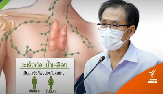 "มะเร็งต่อมน้ำเหลือง" พบบ่อยในคนไทย แนะหมั่นสังเกตตนเอง