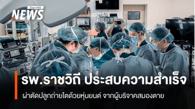 รพ.ราชวิถี ผ่าตัดปลูกถ่ายไต ด้วยหุ่นยนต์สำเร็จครั้งแรกในไทย จากผู้บริจาคสมองตาย