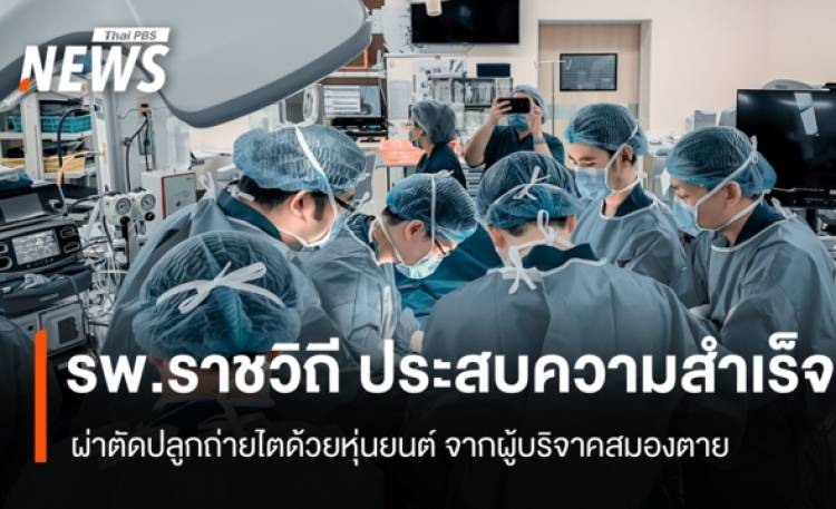 รพ.ราชวิถี ผ่าตัดปลูกถ่ายไตด้วยหุ่นยนต์สำเร็จครั้งแรกในไทย จากผู้บริจาคสมองตาย