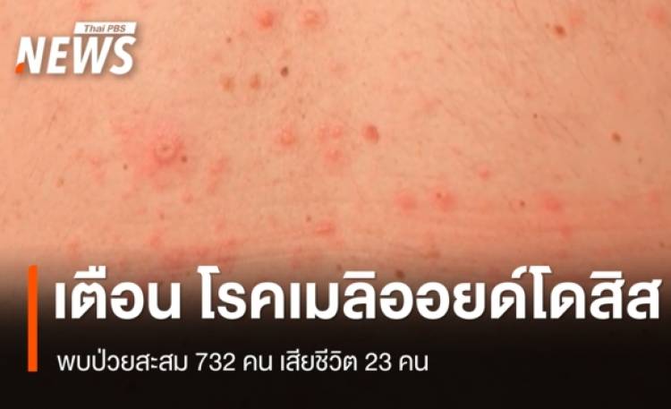 เตือนเฝ้าระวัง 