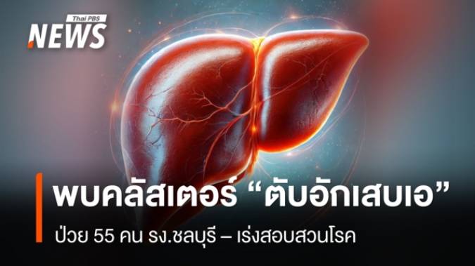 พบคลัสเตอร์ “ไวรัสตับอักเสบเอ” โรงงานชลบุรี ป่วย 55 คน - เร่งสอบสวนโรค