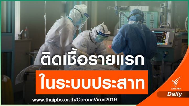 แพทย์ปักกิ่งยืนยันผู้ป่วยรายแรก ‘ติด COVID-19 ในระบบประสาท’