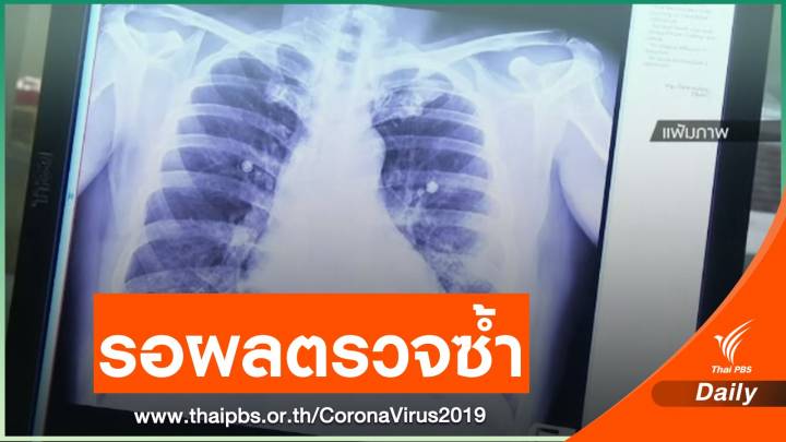 เปิดไทม์ไลน์ พนักงานร้านอาหารชาวอินเดียติด COVID-19 ในไทย ตรวจซ้ำไม่พบเชื้อ