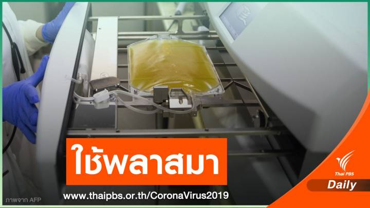 "หมอยง" เผยไทยใช้พลาสมารักษาต่างชาติป่วย COVID-19