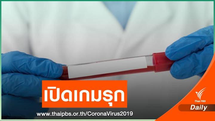 "หมอยง" แนะตรวจ COVID-19 แรงงานข้ามชาติทั้งประเทศ