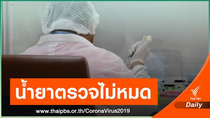 กรมวิทย์ฯยืนยันน้ำยาตรวจ COVID-19 ไม่ขาดแคลน