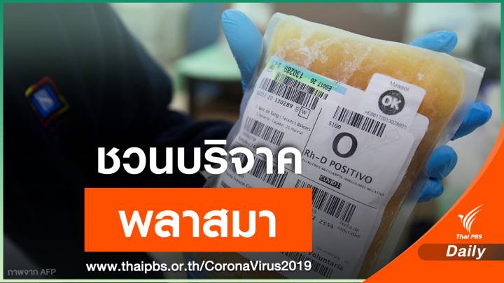"นพ.ยง" เผยพลาสมาจากผู้หายป่วยโควิดช่วยลดความรุนแรงโรค