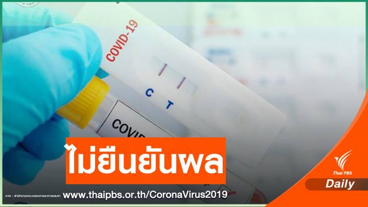 สธ.เตือนอย่าหลงเชื่อ Rapid Test ตรวจภูมิคุ้มกันหลังฉีดวัคซีน