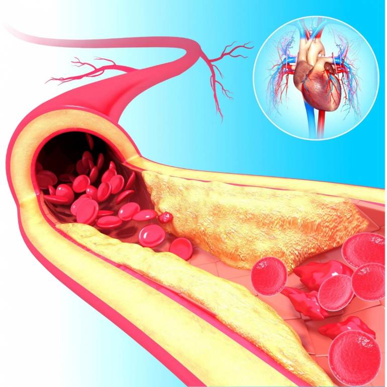 ภาพประกอบข่าว