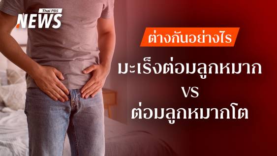 ไขข้อสงสัย &quot;ต่อมลูกหมากโต&quot; ไม่ใช่ &quot;มะเร็งต่อมลูกหมาก&quot; จริงหรือไม่ 