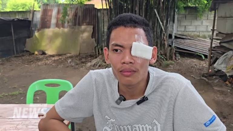 พลทหารตะวัน สิงห์เรือง วีรบุรุษชายแดน สูญเสียการมองเห็นดวงตาซ้ายจากเหตุสู้รบที่ภูมะเขือ จ.อุบลราชธานี