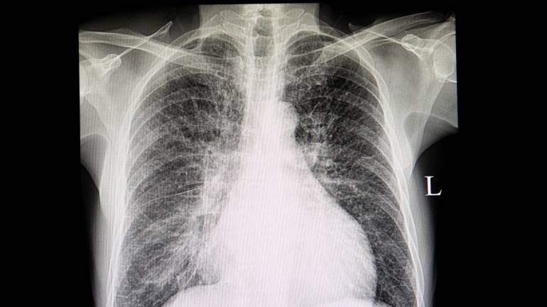ภาพ x-ray ร่างกายมนุษย์
