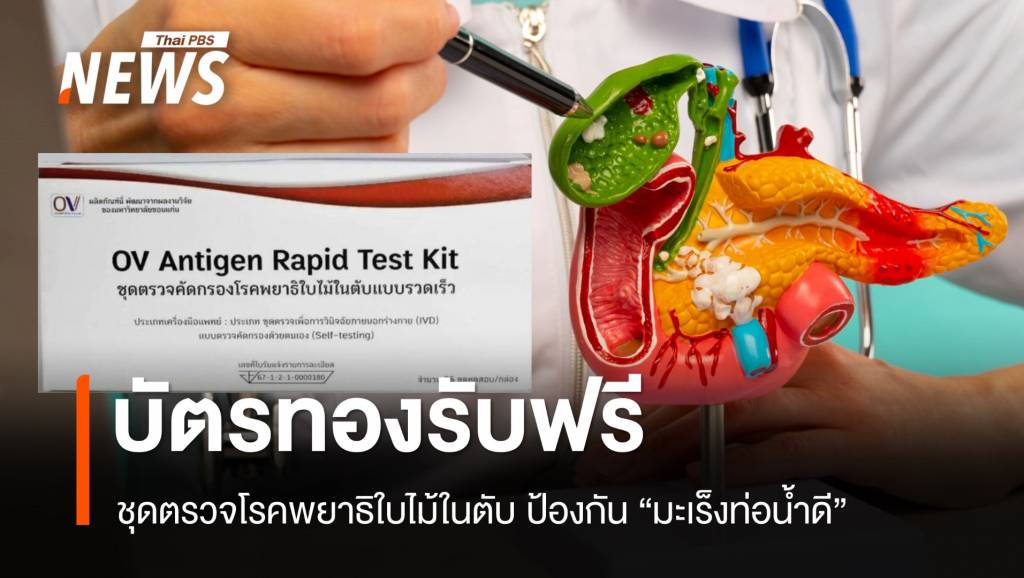 บัตรทองรับฟรี “ชุดตรวจพยาธิใบไม้ในตับ” ป้องกัน “มะเร็งท่อน้ำดี”