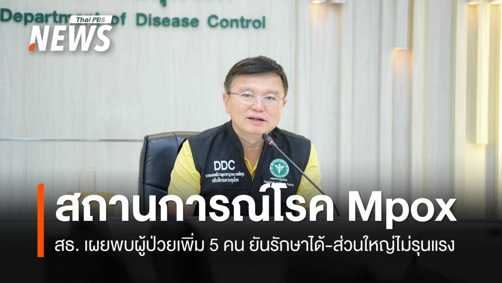 กรมควบคุมโรค อัปเดตสถานการณ์ &#8220;โรคฝีดาษวานร&#8221; พบผู้ป่วยใหม่ 5 คน