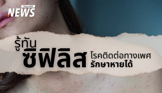 "ซิฟิลิส" โรคเก่าระบาดใหม่! ภัยเงียบโรคติดต่อทางเพศสัมพันธ์
