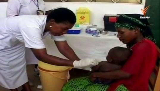 เตรียมใช้วัคซีนป้องกันเชื้อมาลาเรียครั้งแรกของโลก